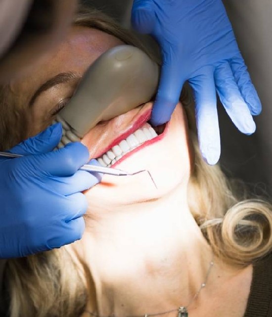 London vs Turkey – Dental Tourism